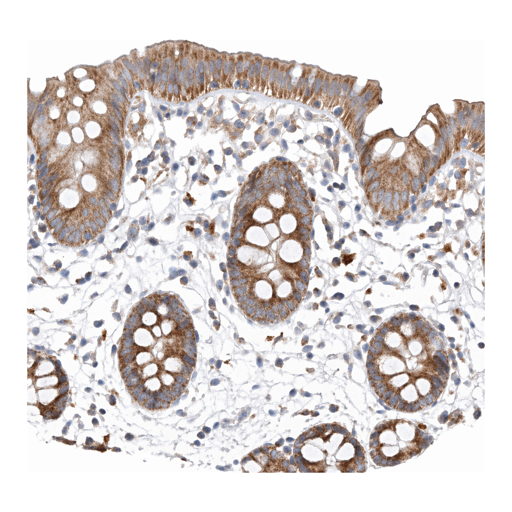 Atlas Antibodies Anti-MRPL24 Antibody