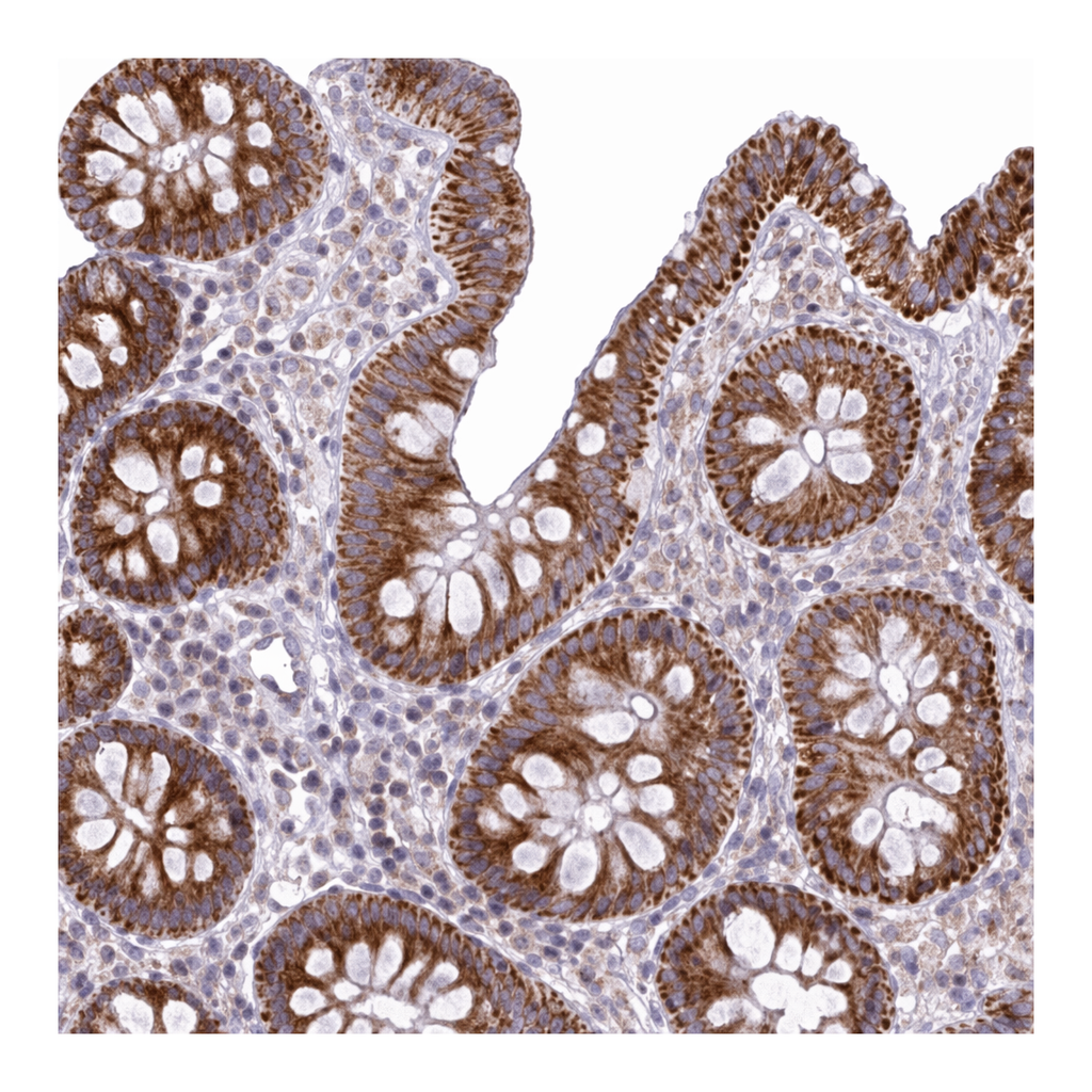 Atlas Antibodies Anti-MRPL19 Antibody