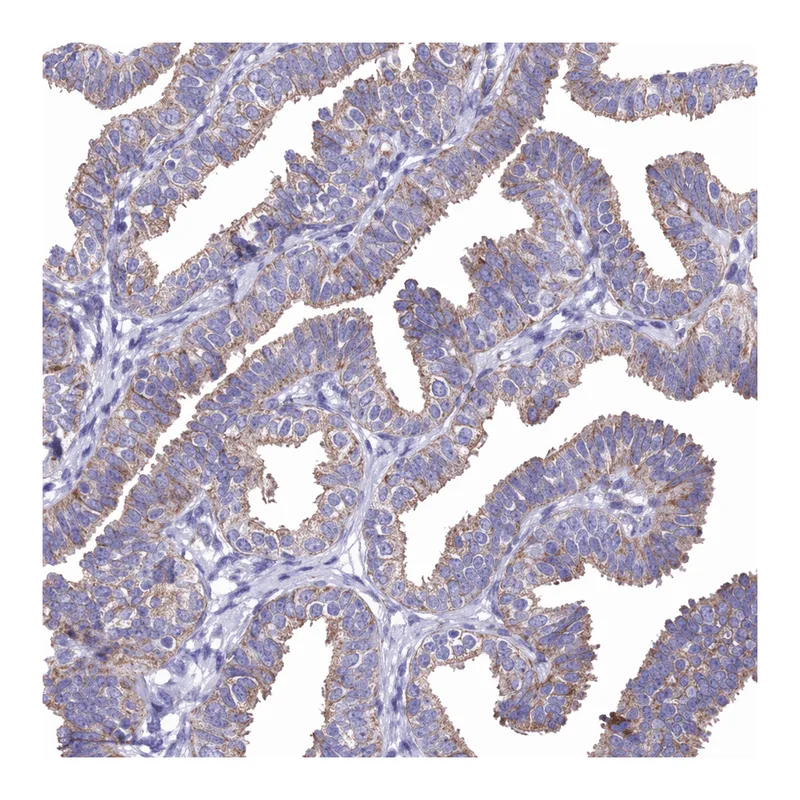 Atlas Antibodies Anti-MRPL3 Antibody