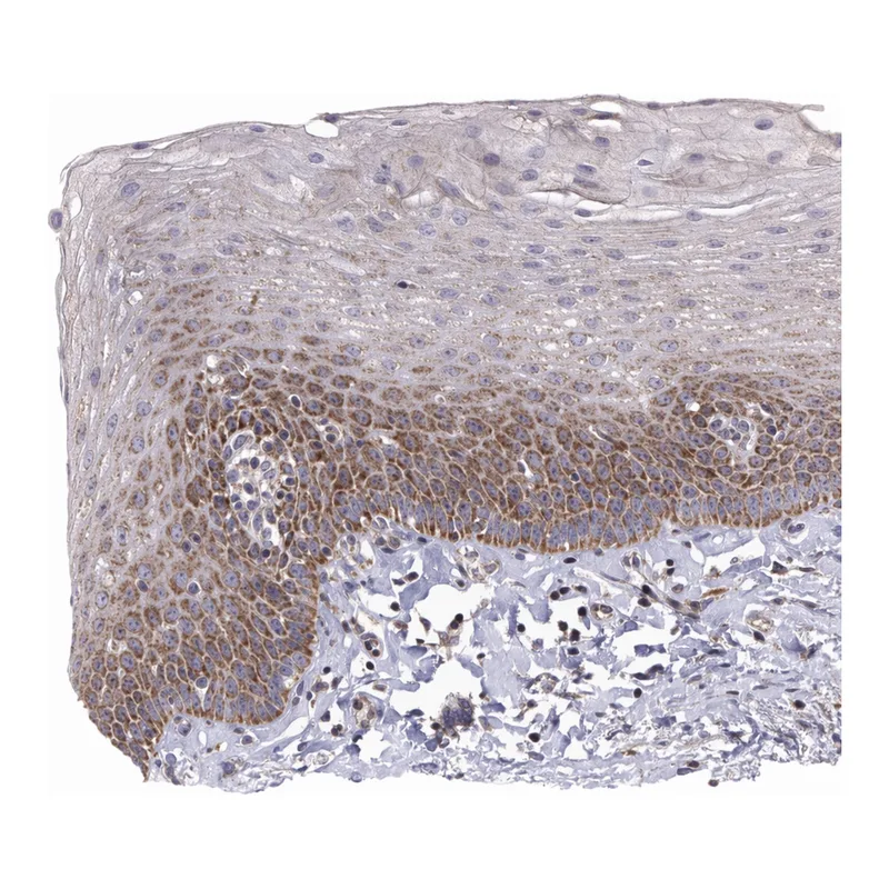 Atlas Antibodies Anti-MRPL3 Antibody