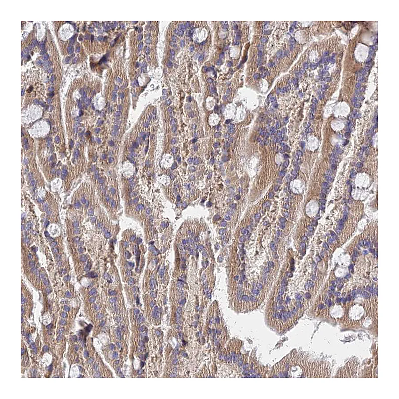 Atlas Antibodies Anti-MRPL35 Antibody