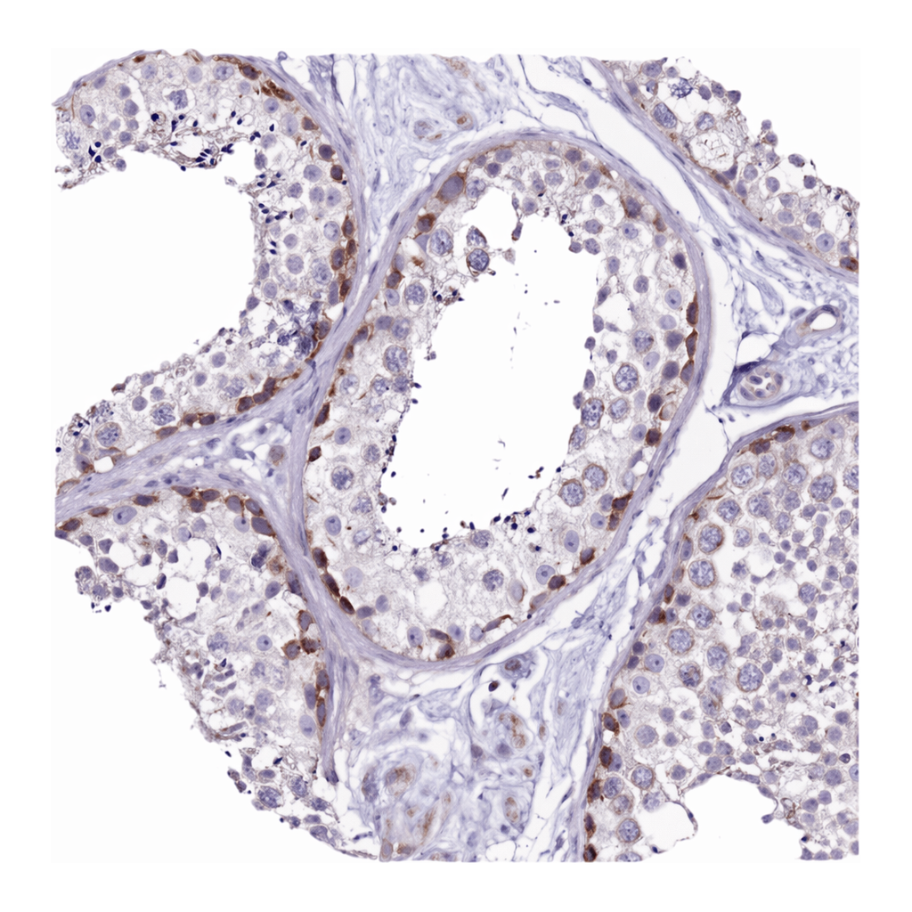 Atlas Antibodies Anti-MRPL36 Antibody