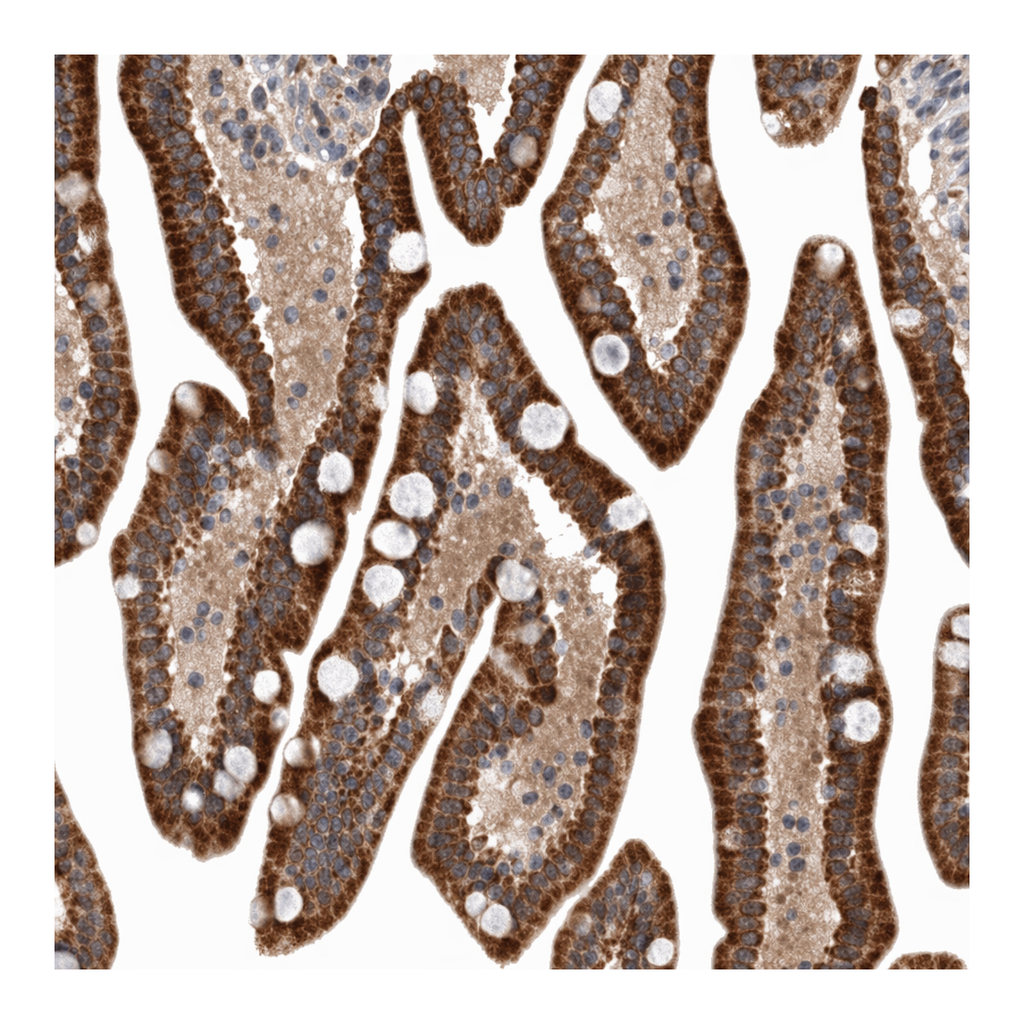 Atlas Antibodies Anti-MRPL37 Antibody