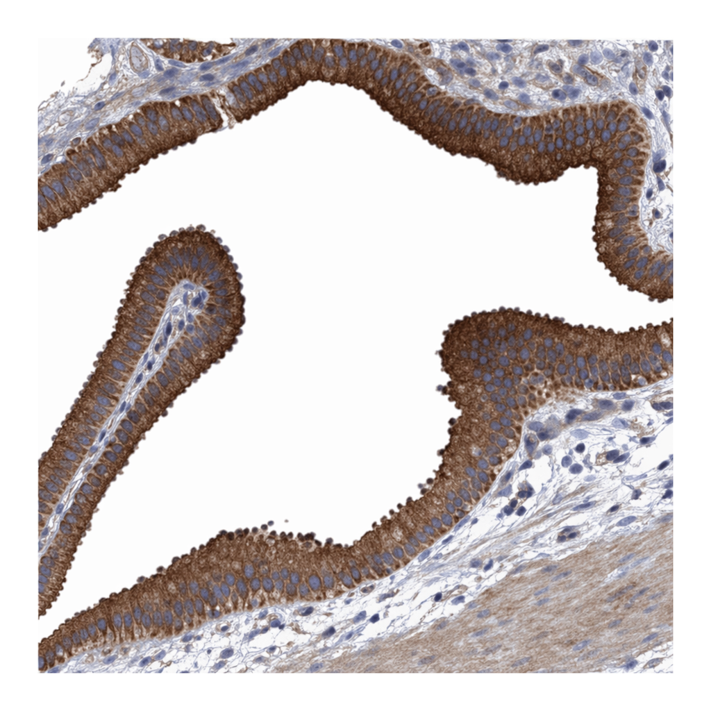 Atlas Antibodies Anti-MRPL38 Antibody