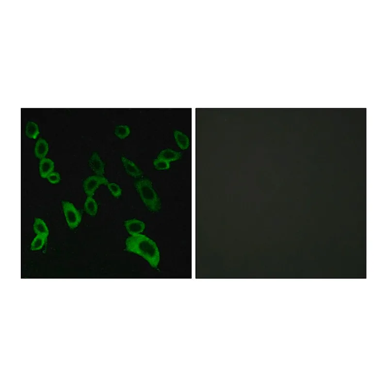 Merck Anti-GPR139 antibody produced in rabbit