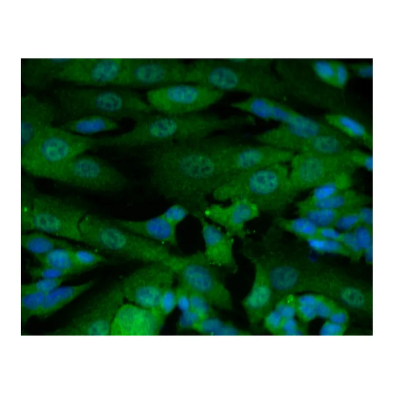 BD Purified Mouse Anti-Glucocorticoid Receptor