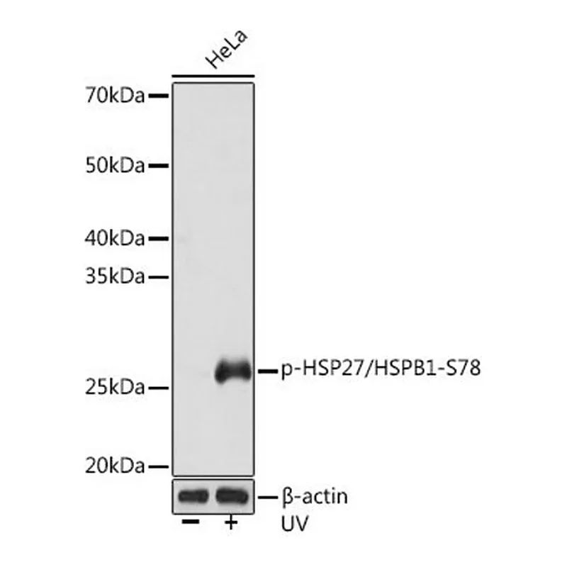 Merck Anti-Phospho-HSP27/HSPB1-S78 antibody produced in rabbit