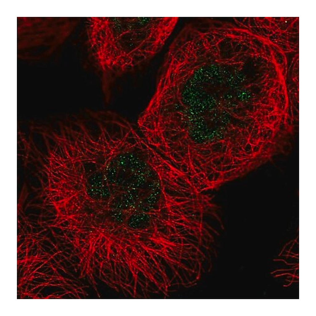 Merck Anti-FANCC antibody produced in rabbit
