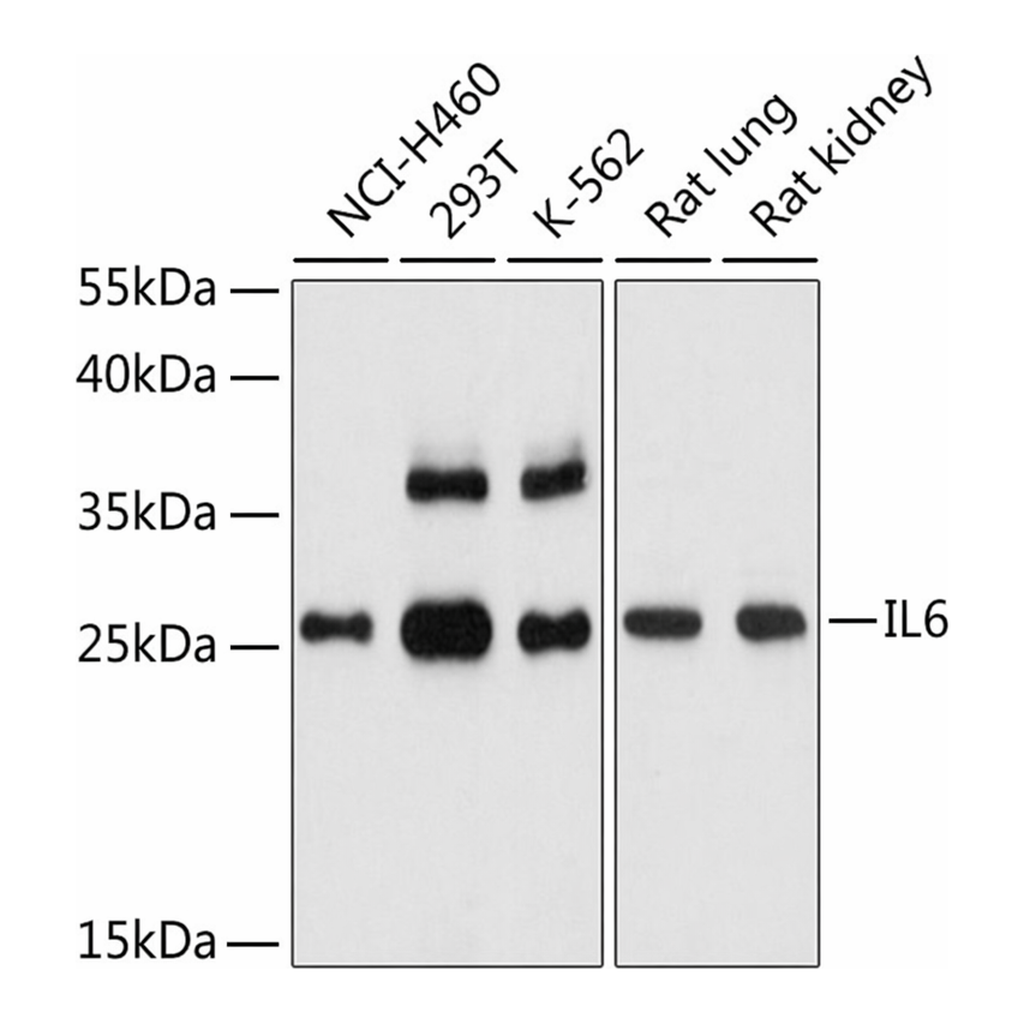Merck ANTI-IL6 ANTIBODY PRODUCED IN RABBIT
