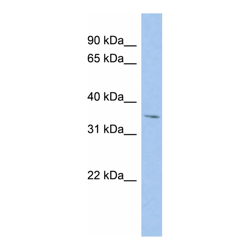 Merck Anti-MPST antibody produced in rabbit