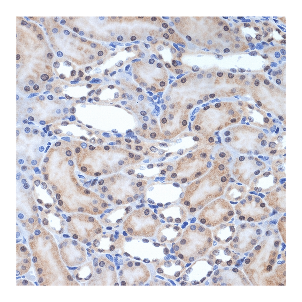 Merck Anti-XPD/ERCC2 antibody produced in rabbit