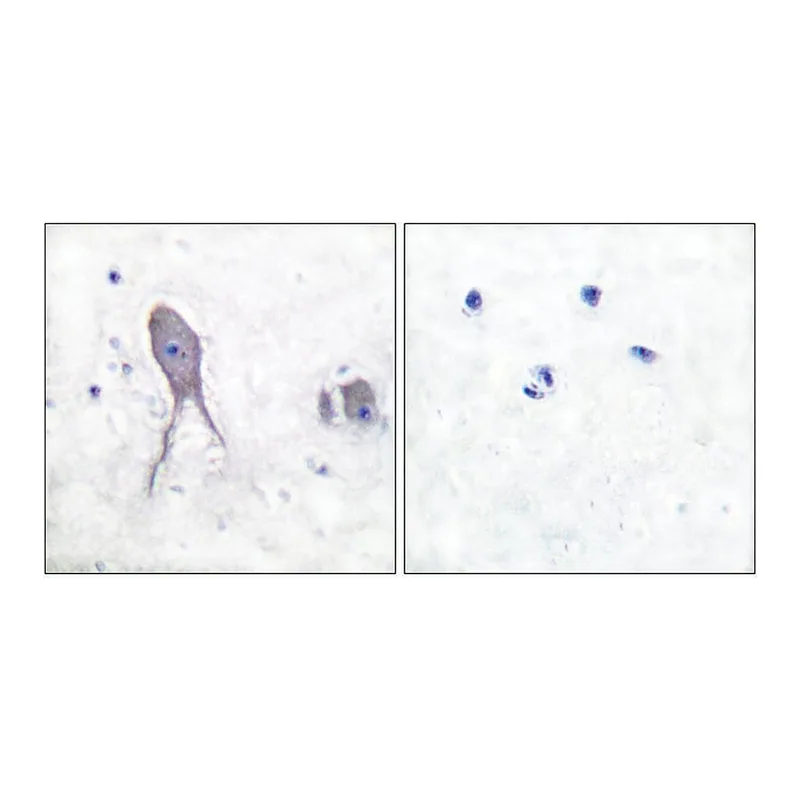 Merck Anti-NOTCH2 (Cleaved-Asp1733) antibody produced in rabbit