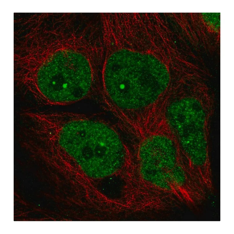Merck Anti-AFF4 antibody produced in rabbit