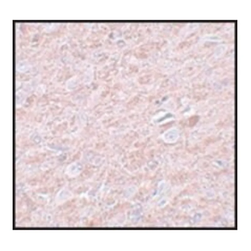 Merck ANTI-PRDM16