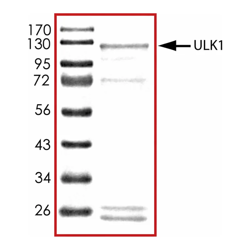 Merck ULK1 (1-649), active, GST tagged human