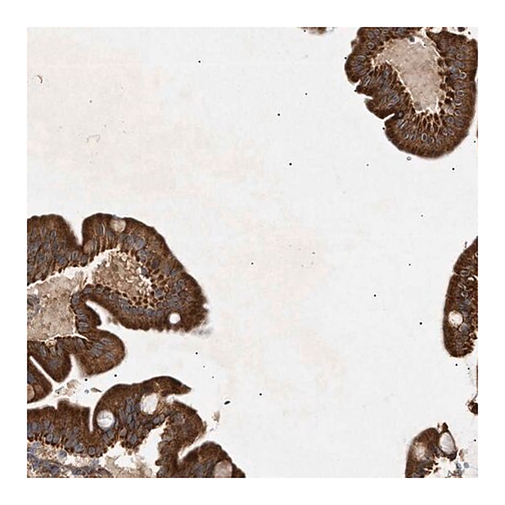 Merck Anti-MTCH1 antibody produced in rabbit