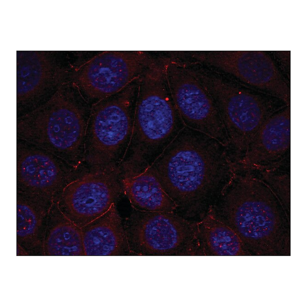 Merck Anti-phospho-IGF1R (pTyr1165/pTyr1166) antibody produced in rabbit
