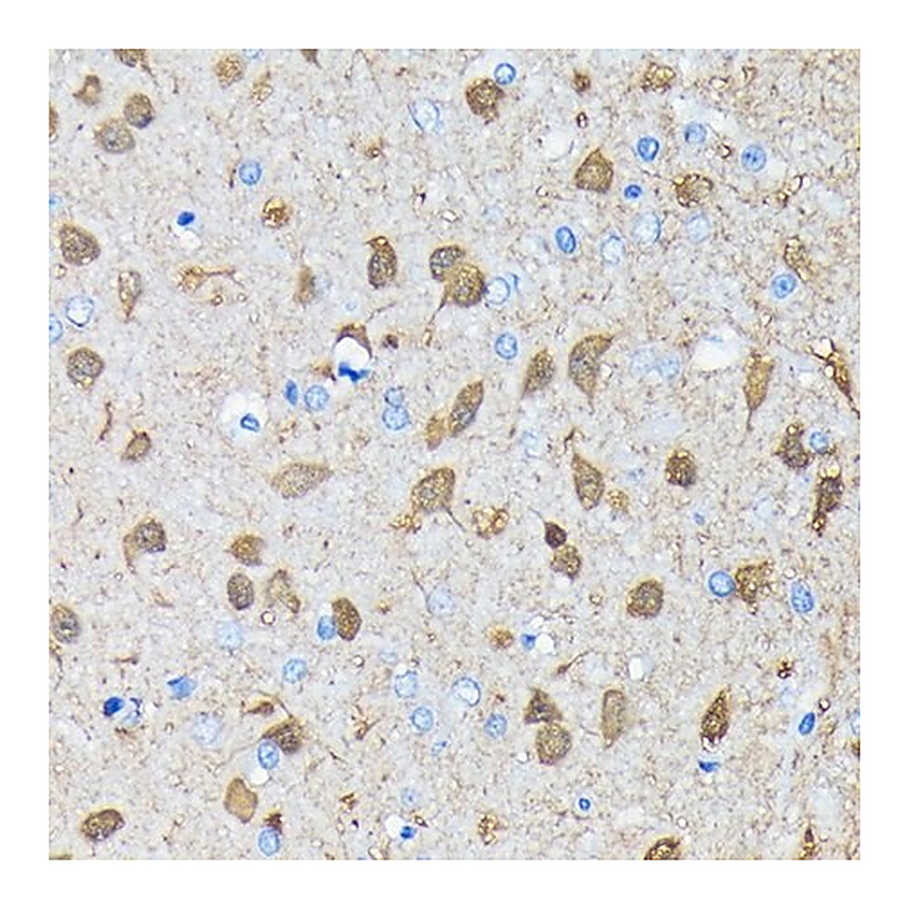 Merck Anti-PGP9.5/UCHL1 antibody produced in rabbit