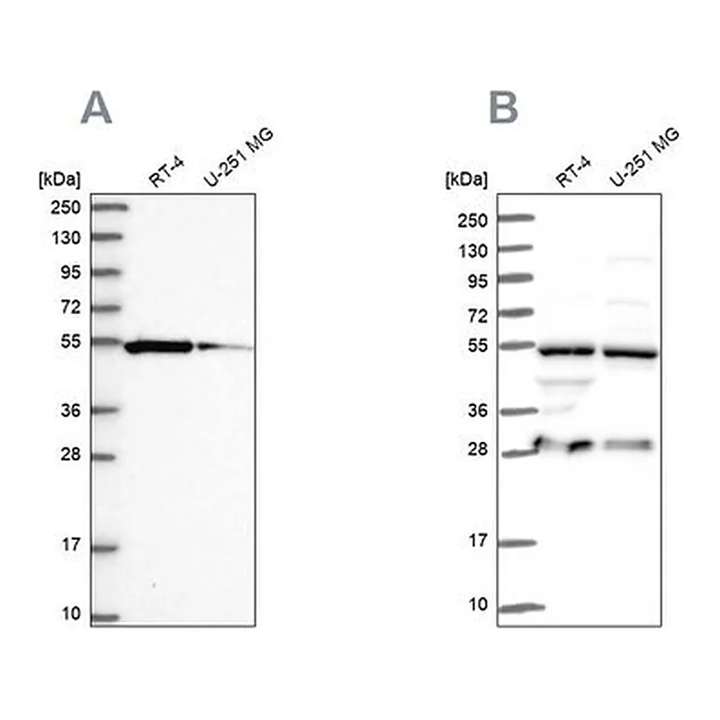 Merck Anti-PACSIN3 antibody produced in rabbit