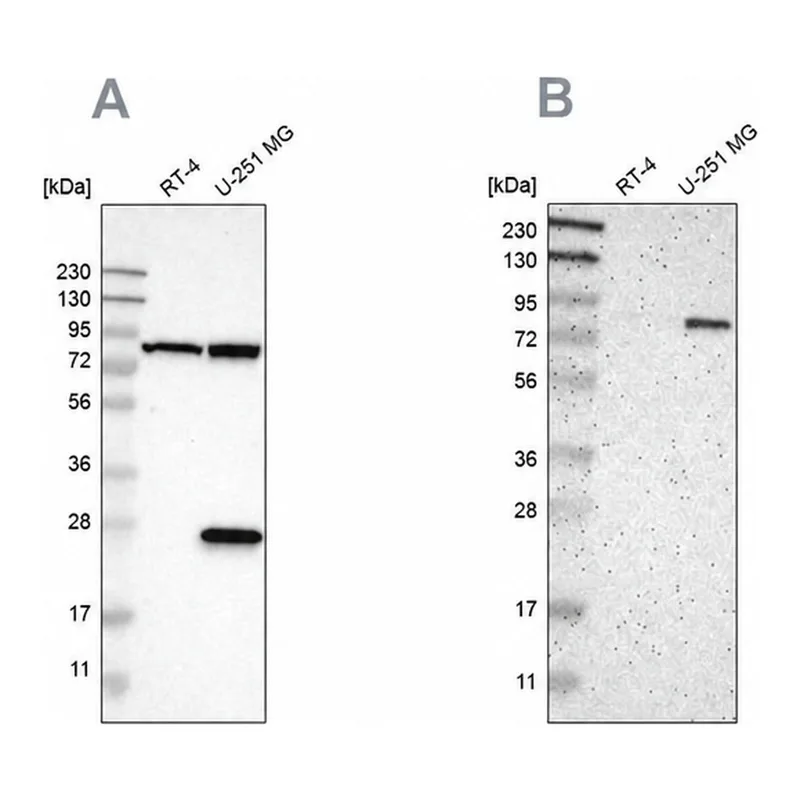 Merck Anti-ALDH18A1 antibody produced in rabbit