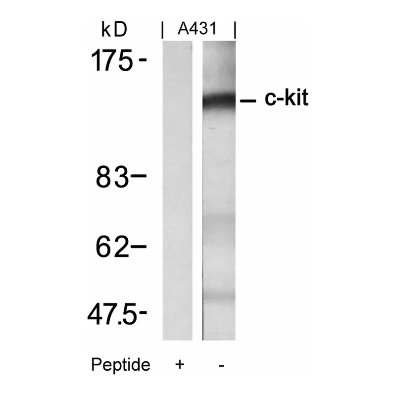 Merck Anti-KIT (Ab-721) antibody produced in rabbit