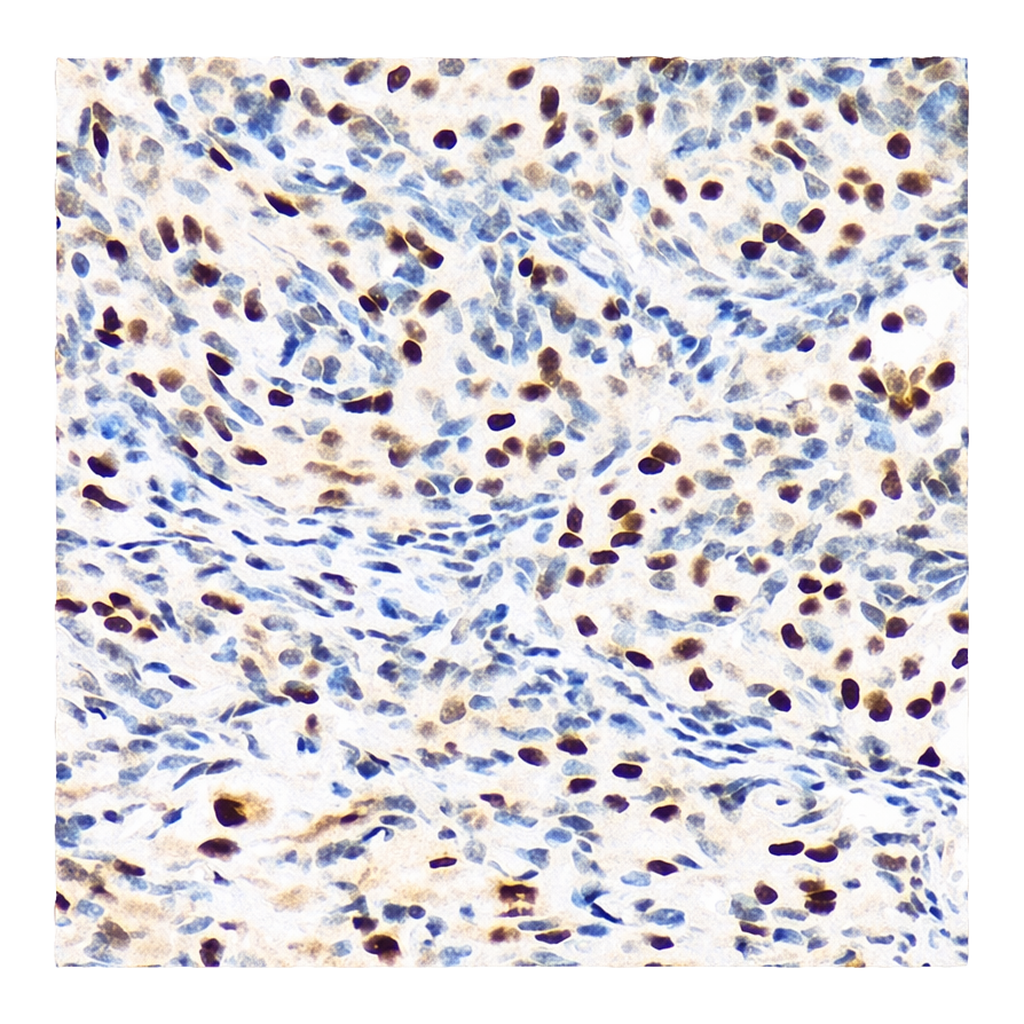 Merck Anti-PBRM1 antibody produced in rabbit