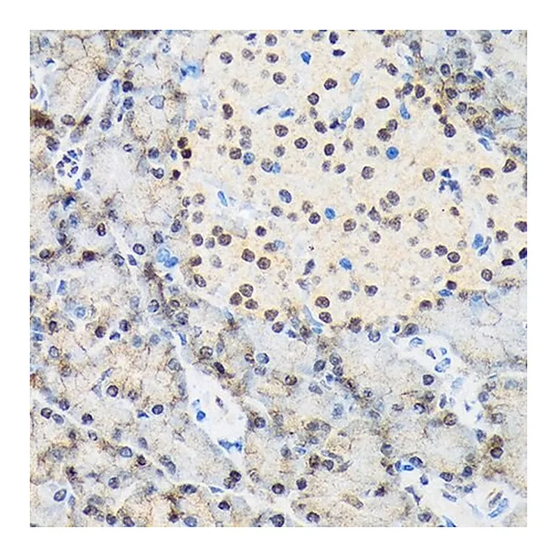 Merck Anti-TARBP2 antibody produced in rabbit