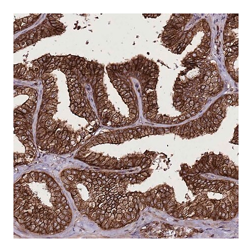 Merck Anti-DHX29 antibody produced in rabbit