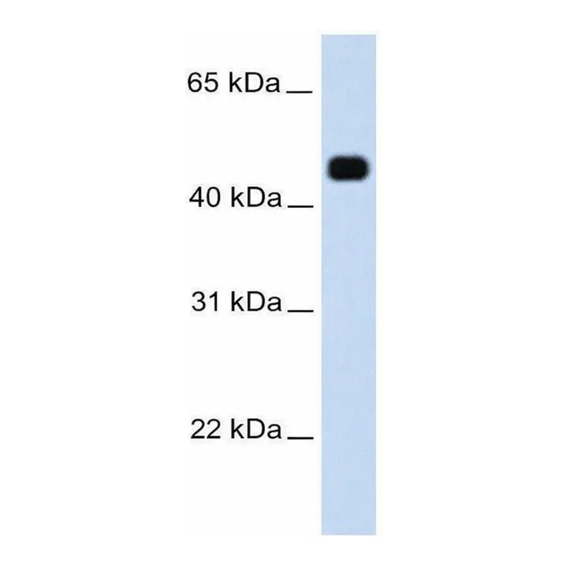 Merck Anti-HMGCS2 (AB2) antibody produced in rabbit