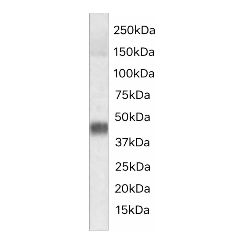 Merck ANTI-SRD5A2 (C-TERMINAL)