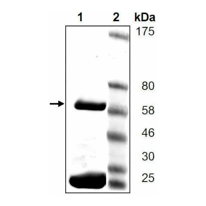 Merck PARP5A active human
