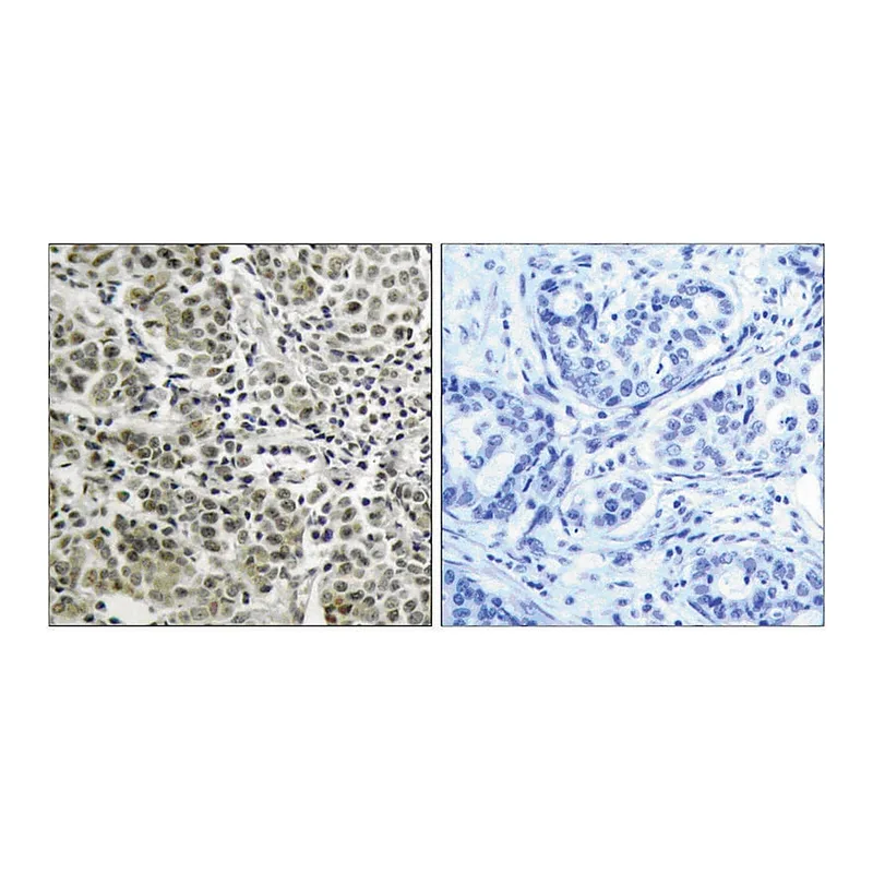 Merck Anti-Androgen Receptor antibody produced in rabbit