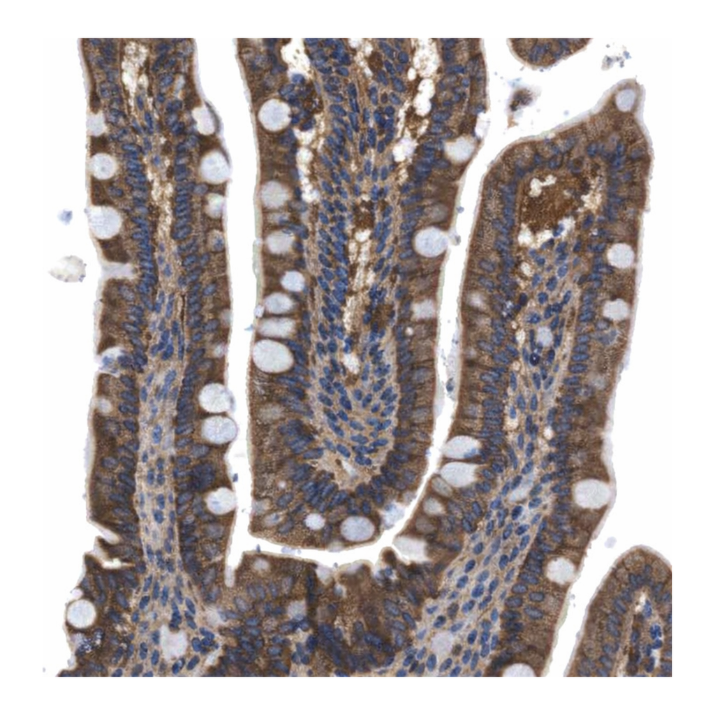 Merck Anti-DENND4C antibody produced in rabbit