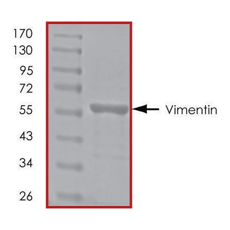 Merck Vimentin, His tagged human