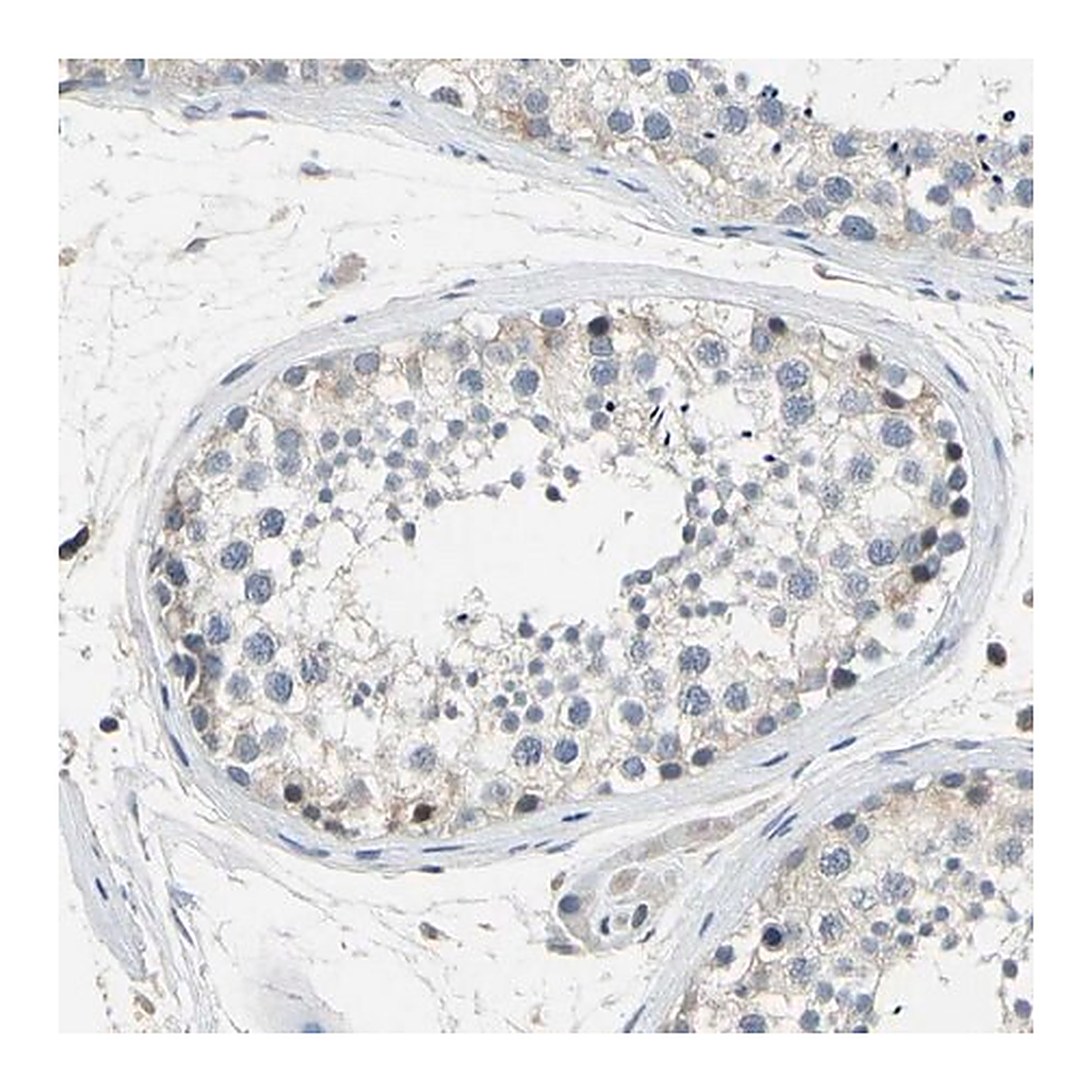 Merck Anti-LHX9 antibody produced in rabbit