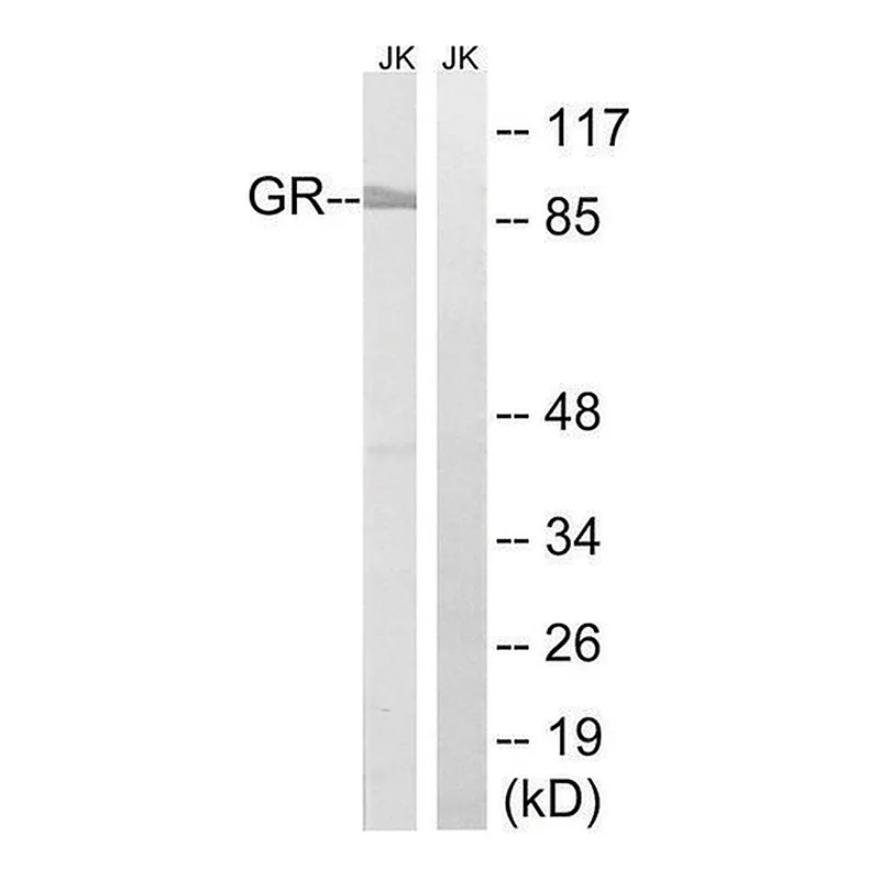 Merck Anti-GR antibody produced in rabbit