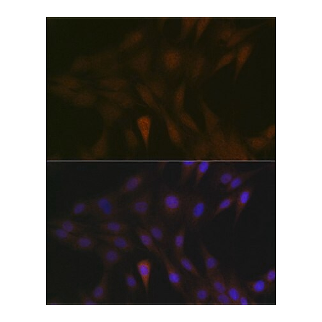 Merck Anti-MEK3 antibody produced in rabbit