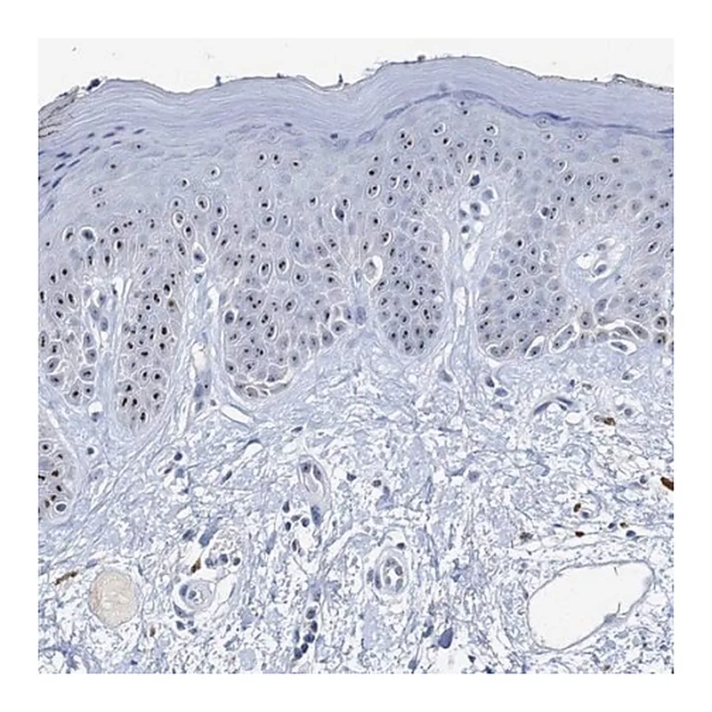 Merck Anti-NOP2 antibody produced in rabbit