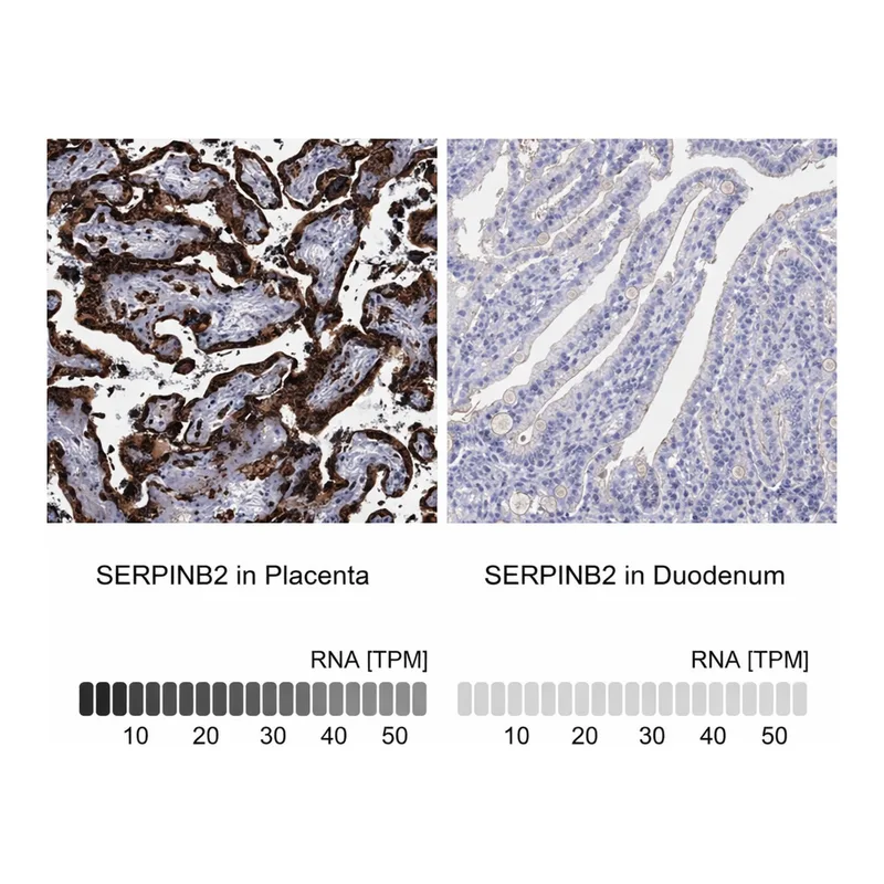 Merck Anti-SERPINB2 antibody produced in rabbit