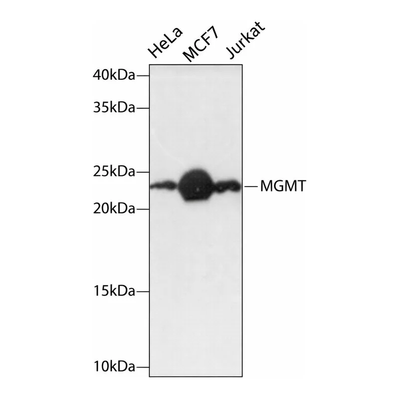 Merck Anti-MGMT antibody produced in rabbit