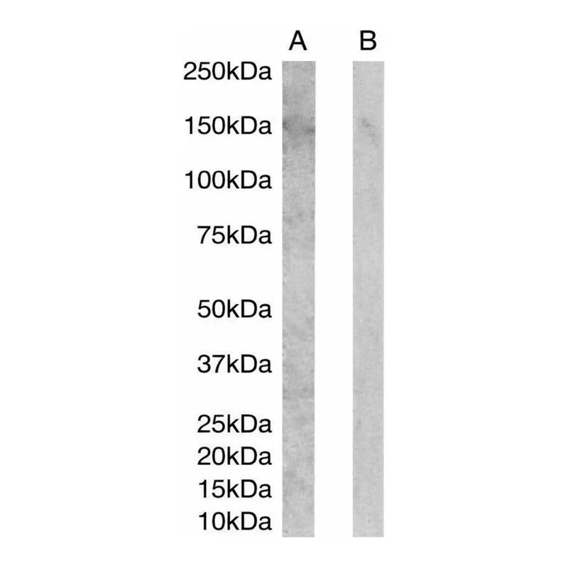 Merck Anti-ERBB3/HER3 antibody produced in goat