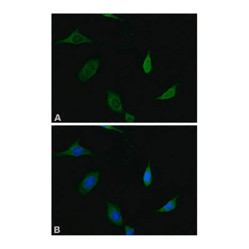 Merck Anti-Munc-18-1 antibody produced in rabbit