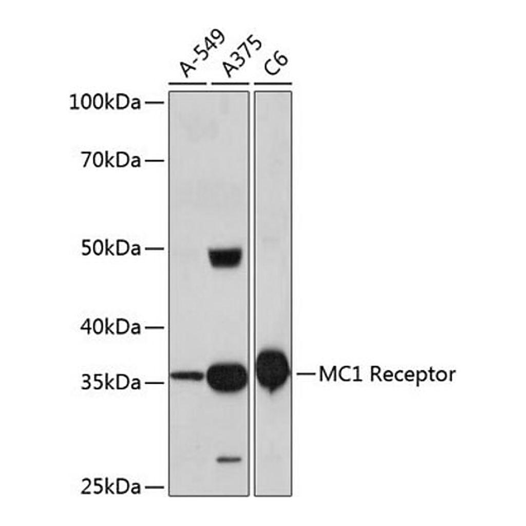 Merck Anti- MC1 Receptor antibody produced in rabbit