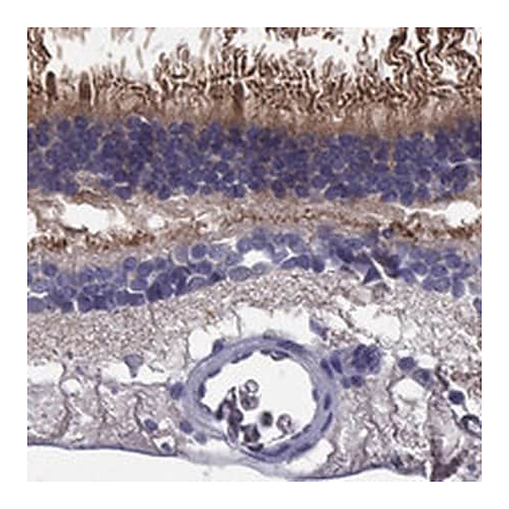 Merck Anti-ABCA4 antibody produced in rabbit