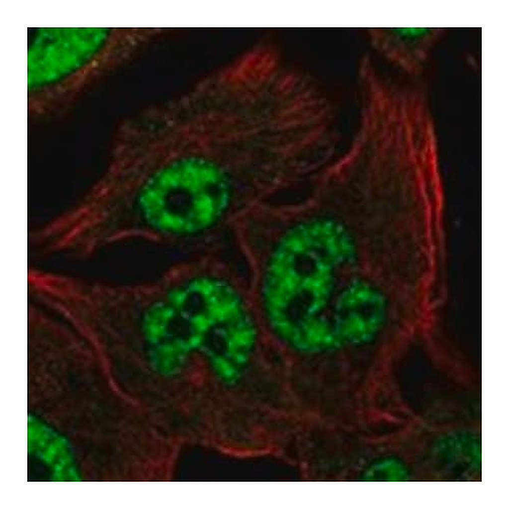 Merck Anti-RNF14 antibody produced in rabbit