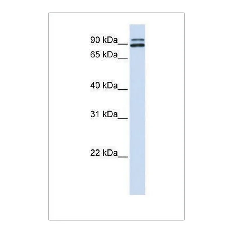Merck Anti-PCSK6
