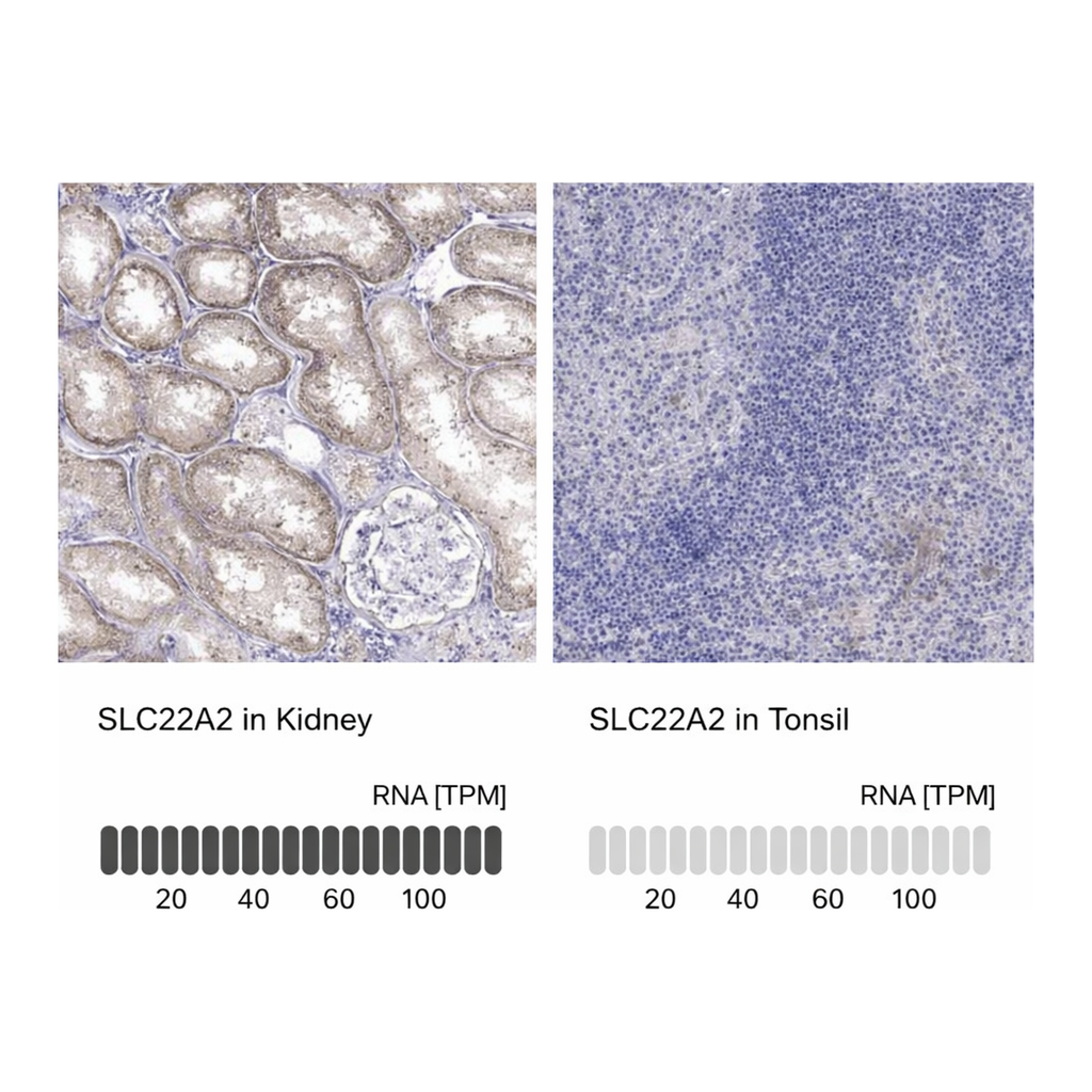 Merck Anti-SLC22A2 antibody produced in rabbit