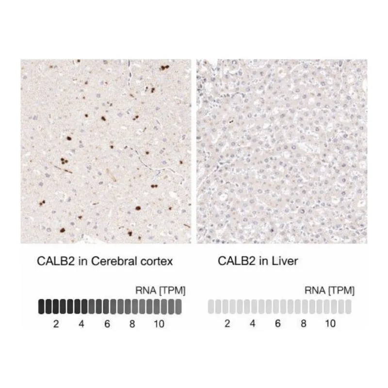 Merck Anti-CALB2 antibody produced in mouse