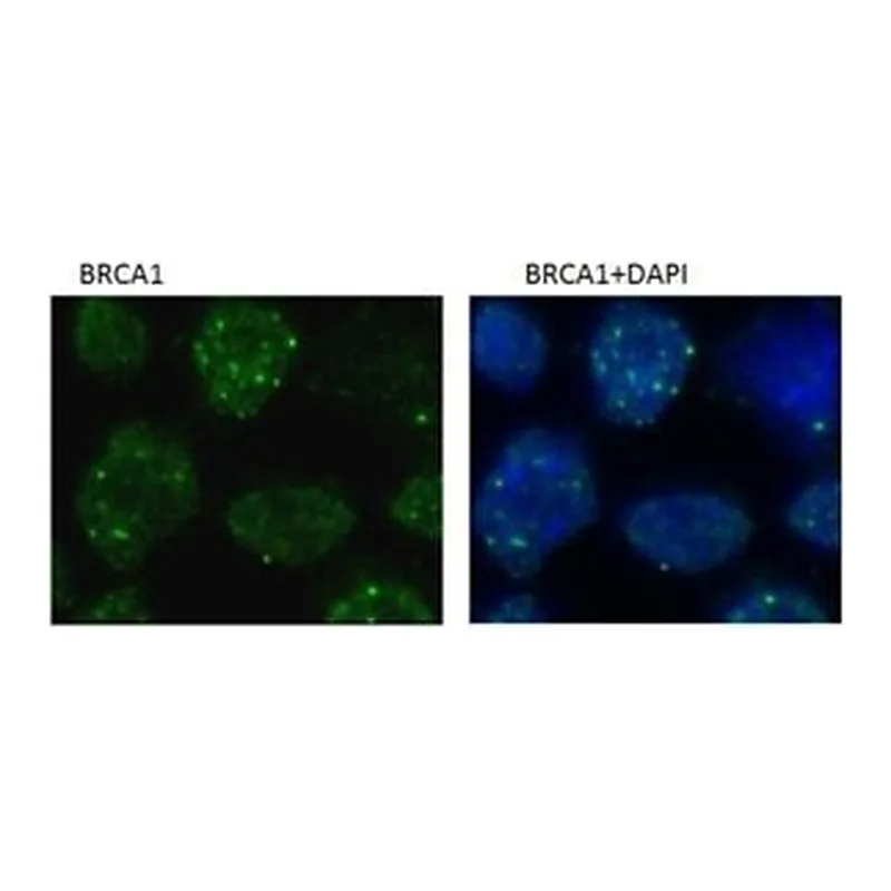 Merck MONOCLONAL ANTI-BRCA1