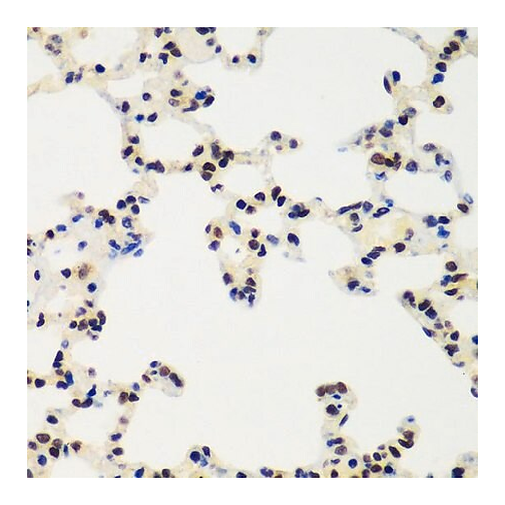 Merck Anti-RING1B/RNF2 antibody produced in rabbit